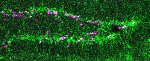 adult neurogenesis hippocampus